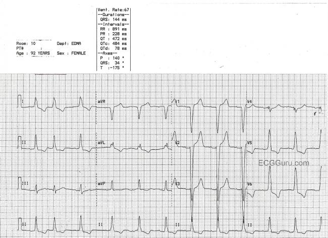 PAC  ECG Guru - Instructor Resources PAC  ECG Guru - Instructor Resources